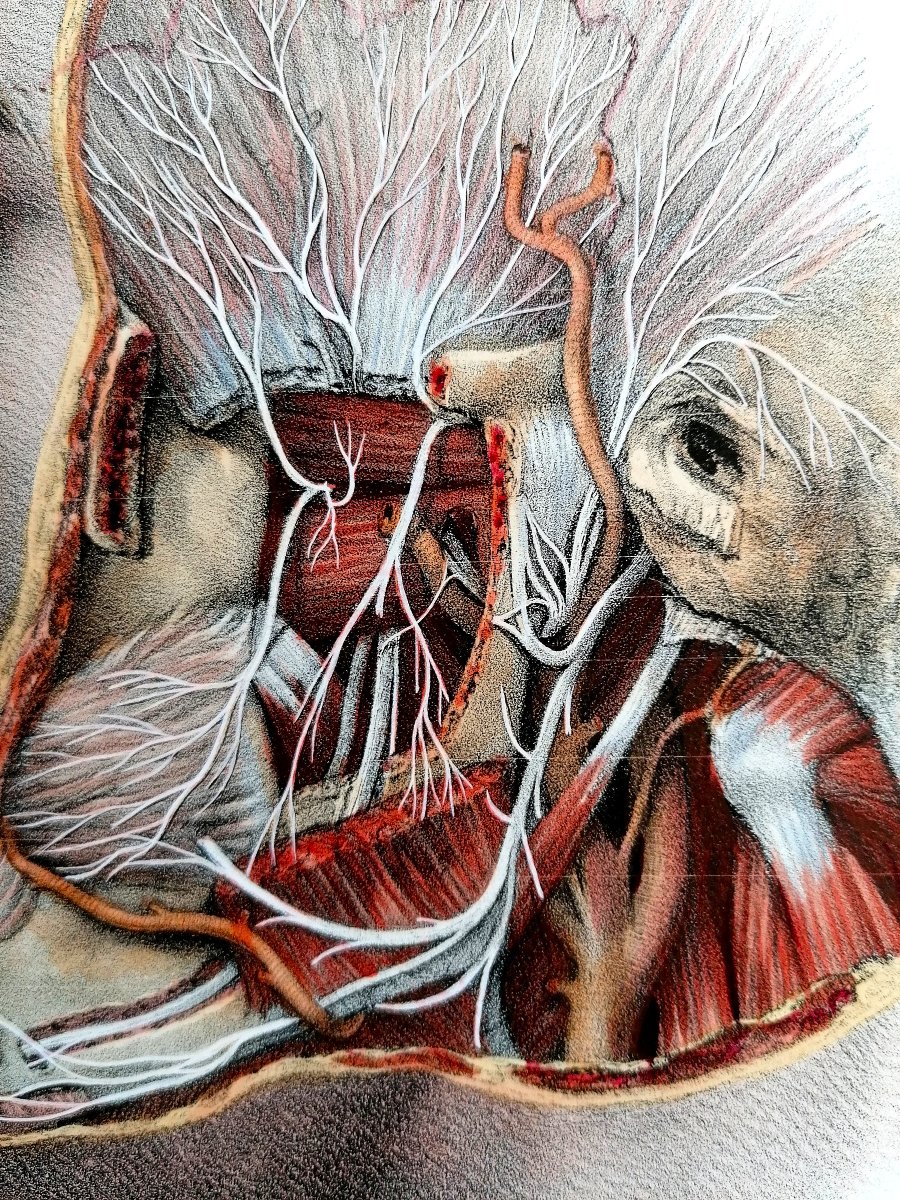 LITHOGRAPHIE - NERF TRIJUMEAU - TRAITE DE L 'ANATOMIE DE L'HOMME - Dr BOURGERY - NH JACOB --photo-1