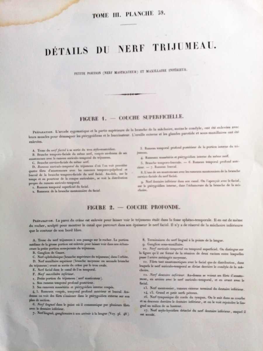 LITHOGRAPHIE - NERF TRIJUMEAU - TRAITE DE L 'ANATOMIE DE L'HOMME - Dr BOURGERY - NH JACOB --photo-3