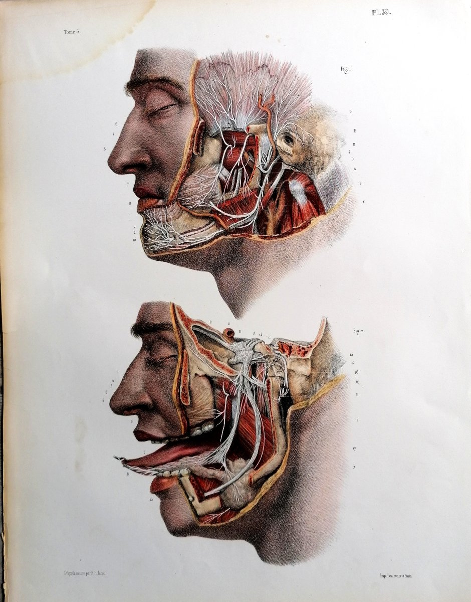 LITHOGRAPHIE - NERF TRIJUMEAU - TRAITE DE L 'ANATOMIE DE L'HOMME - Dr BOURGERY - NH JACOB -