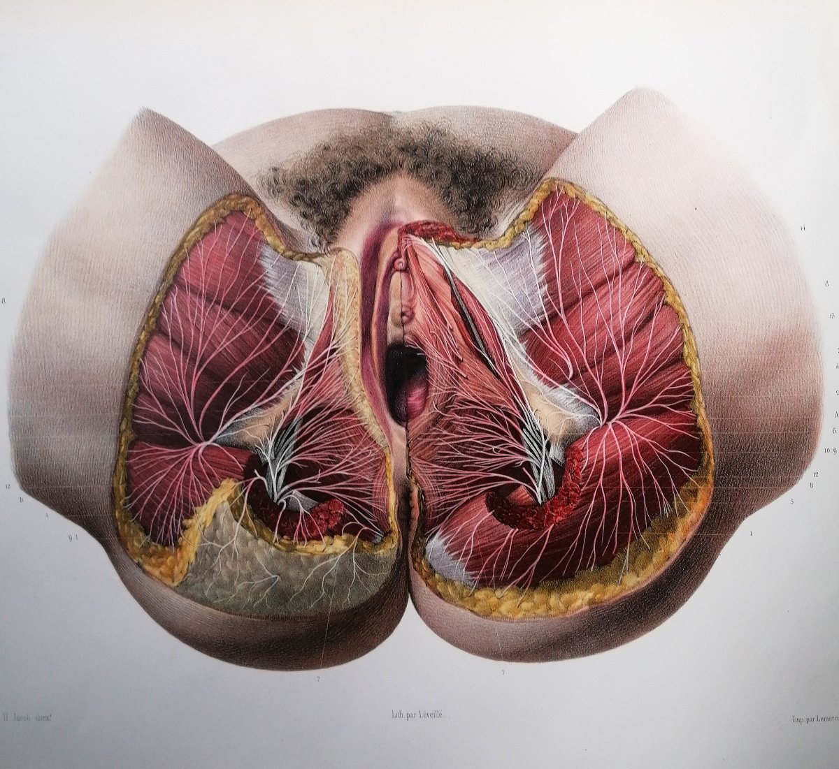 LITHOGRAPHIE - PERINEE DE LA FEMME- TRAITE DE L 'ANATOMIE DE L'HOMME - Dr BOURGERY - NH JACOB --photo-2