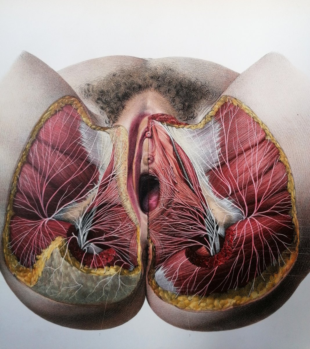 LITHOGRAPHIE - PERINEE DE LA FEMME- TRAITE DE L 'ANATOMIE DE L'HOMME - Dr BOURGERY - NH JACOB --photo-3