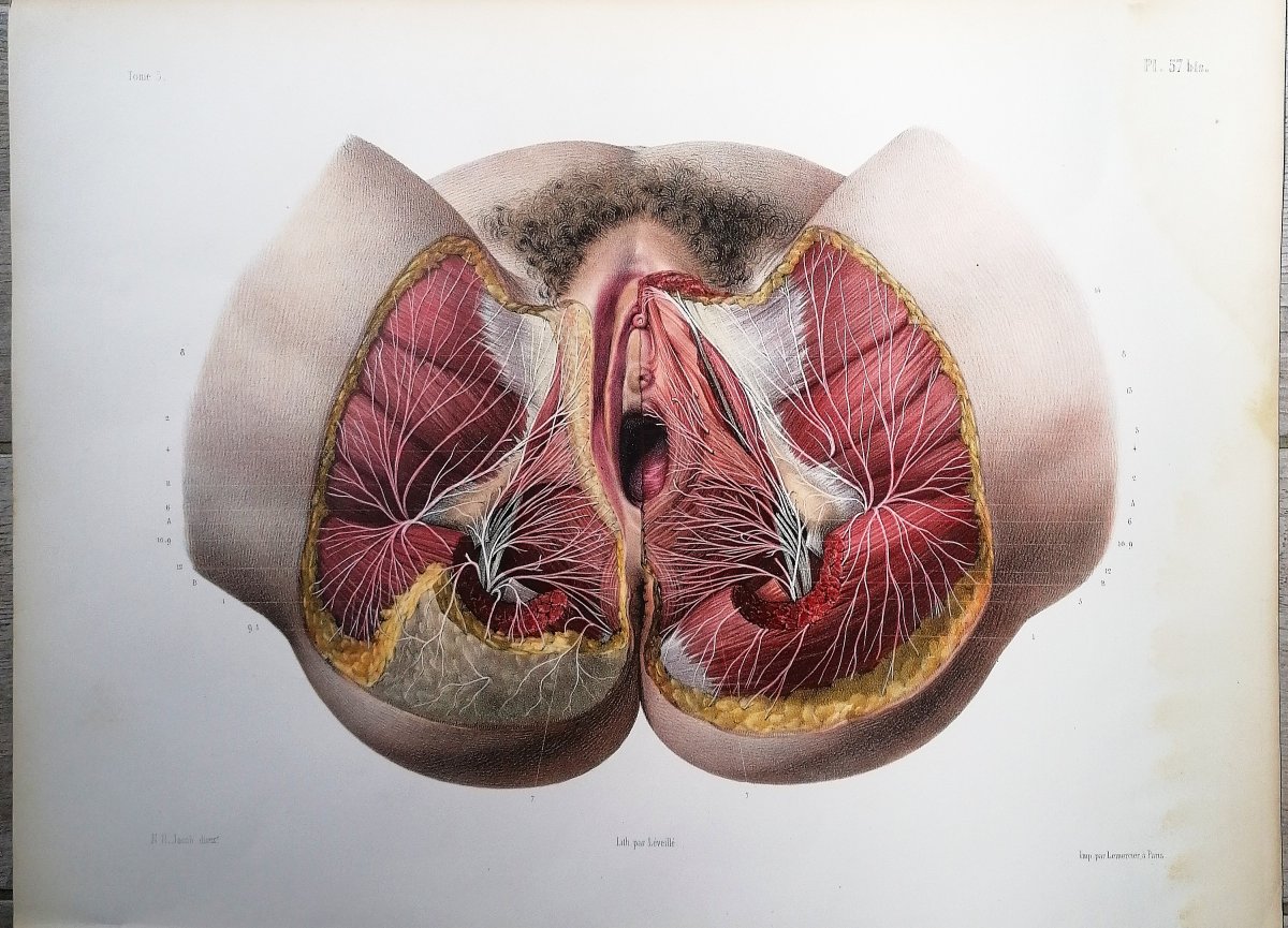 LITHOGRAPHIE - PERINEE DE LA FEMME- TRAITE DE L 'ANATOMIE DE L'HOMME - Dr BOURGERY - NH JACOB -