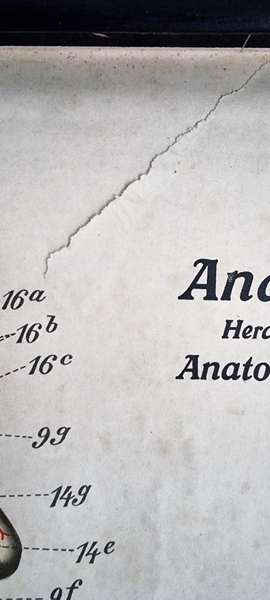 Large Anatomy Board 2 Meters - Flayed Man Frohse Anatomische Wandtafeln Human Body-photo-4