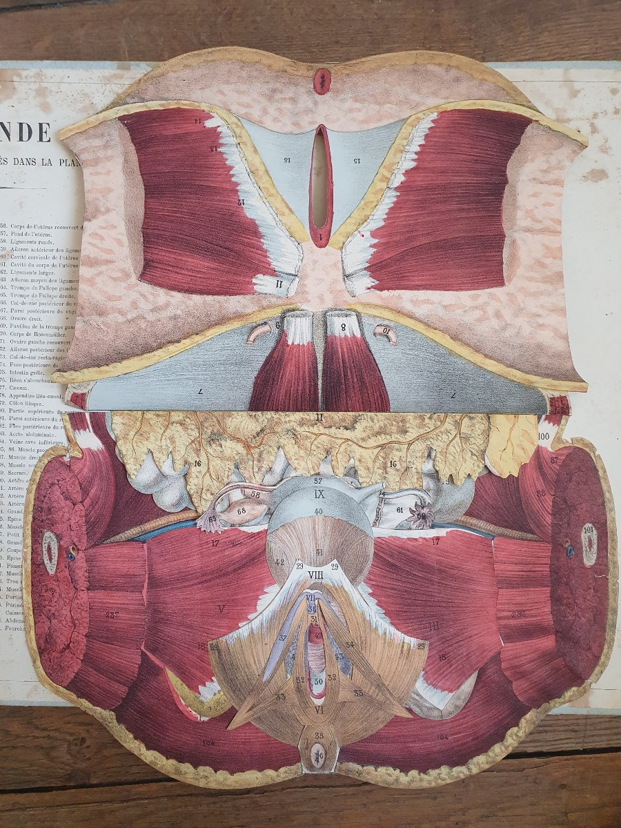 Woman's Perineum Gustave Joseph Witkowski Genital Organs Typography Anatomy Curiosity-photo-2