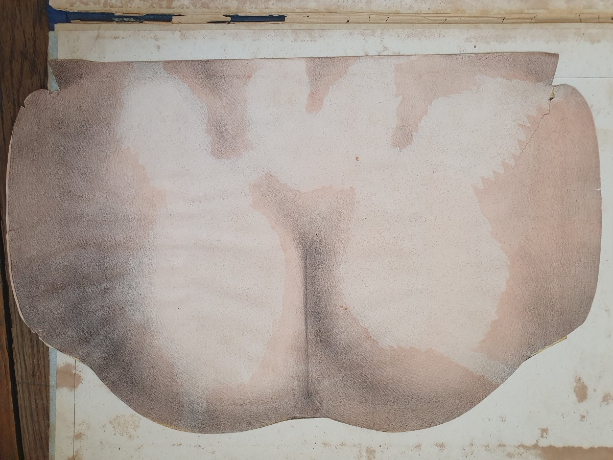 Woman's Perineum Gustave Joseph Witkowski Genital Organs Typography Anatomy Curiosity-photo-3