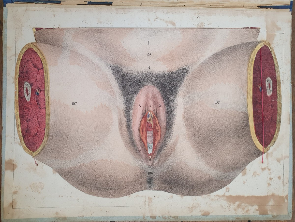 Woman's Perineum Gustave Joseph Witkowski Genital Organs Typography Anatomy Curiosity