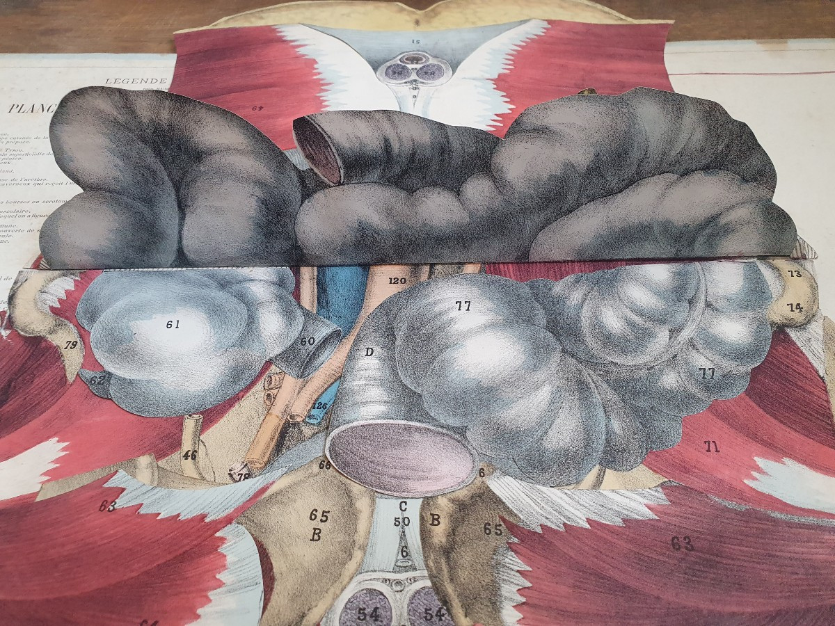 Human Perineum Gustave Joseph Witkowski Genital Organs Typography Anatomy Curiosity-photo-3