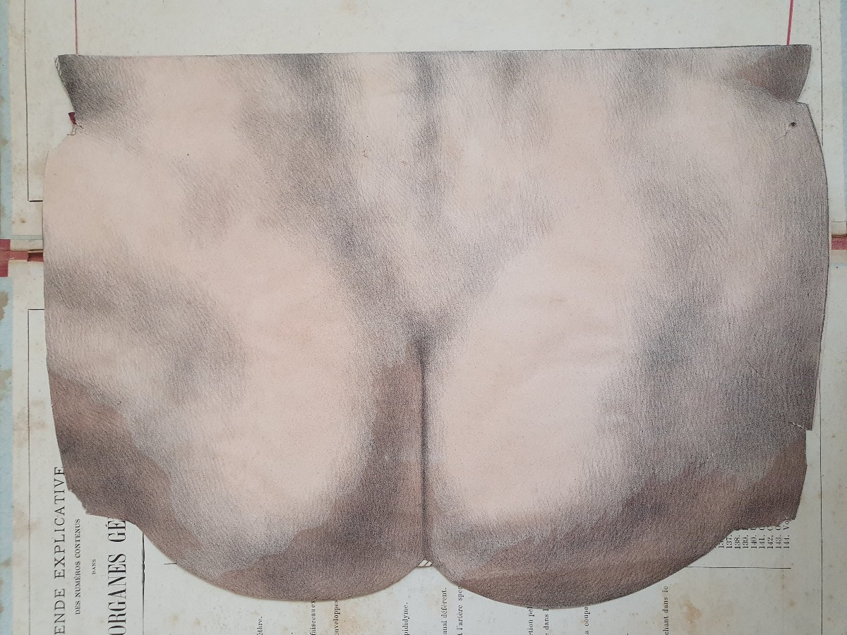 Human Perineum Gustave Joseph Witkowski Genital Organs Typography Anatomy Curiosity-photo-1