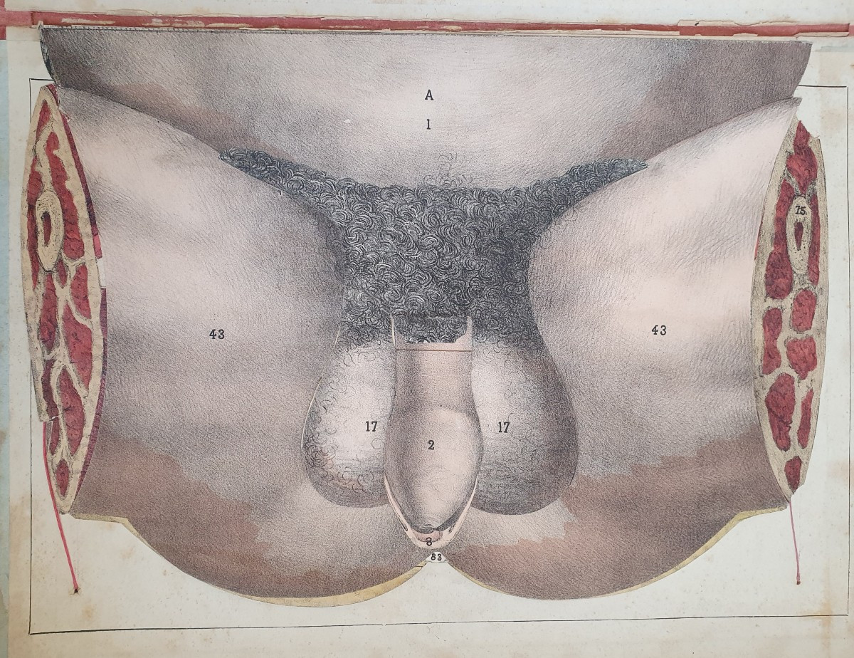 Human Perineum Gustave Joseph Witkowski Genital Organs Typography Anatomy Curiosity