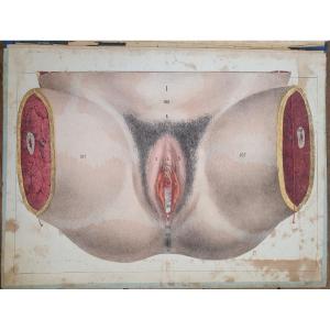 Woman's Perineum Gustave Joseph Witkowski Genital Organs Typography Anatomy Curiosity