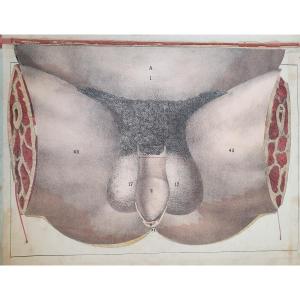 Human Perineum Gustave Joseph Witkowski Genital Organs Typography Anatomy Curiosity