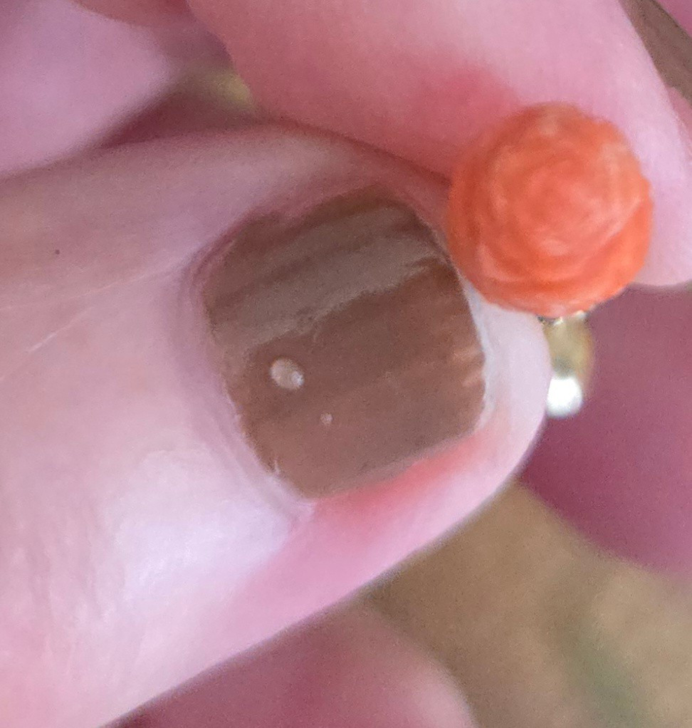 Very Old Pair Of Georgian Earrings -photo-2