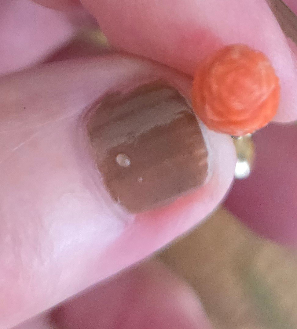Very Old Pair Of Georgian Earrings -photo-3