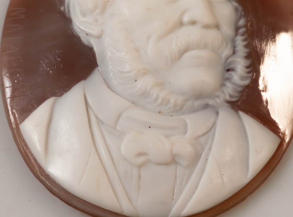 Cameo Portrait Of A Curious Man With Divergent Strabismus - Exotropia By Charles Matabon / Curiosity-photo-3