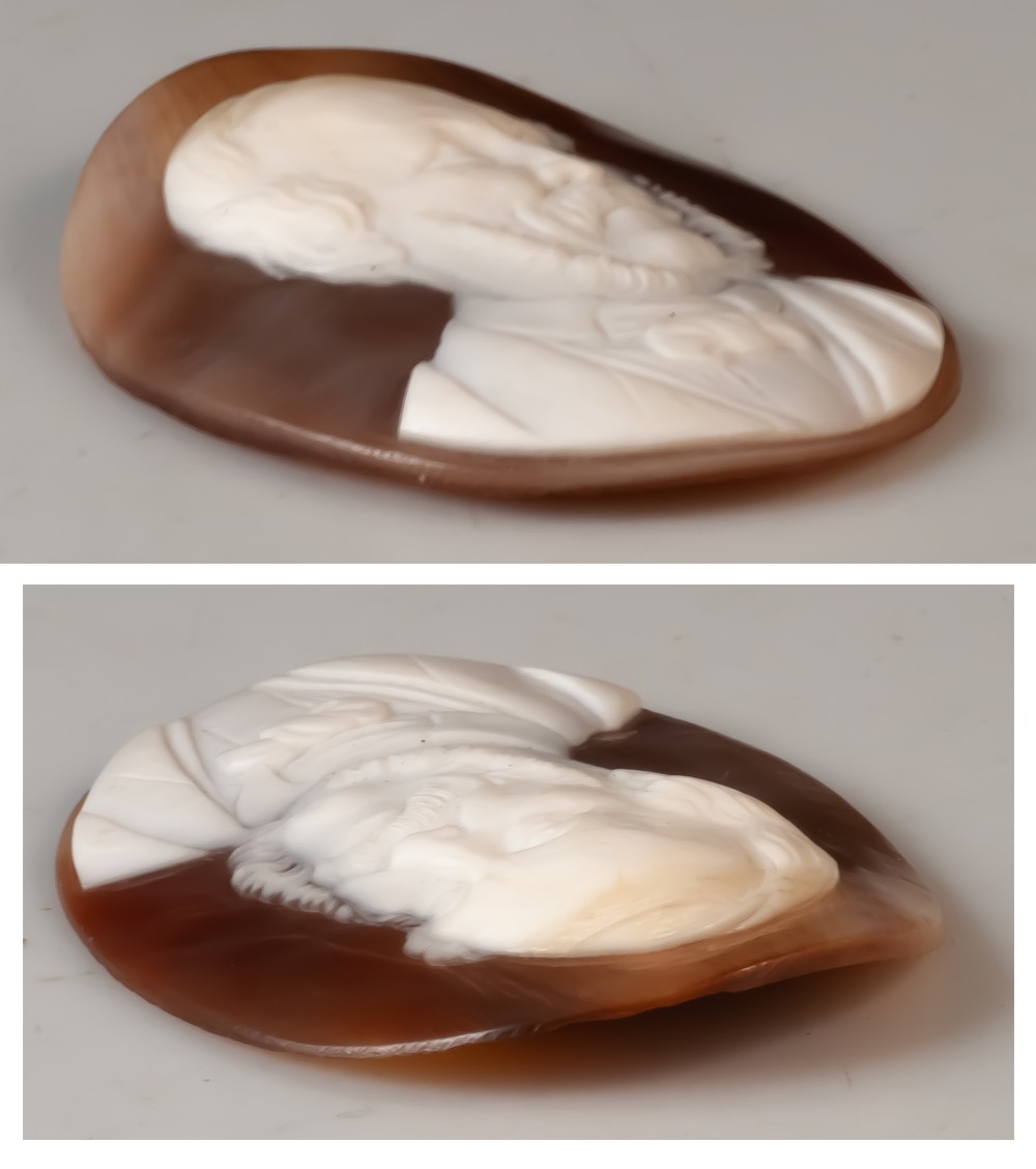 Cameo Portrait Of A Curious Man With Divergent Strabismus - Exotropia By Charles Matabon / Curiosity-photo-1