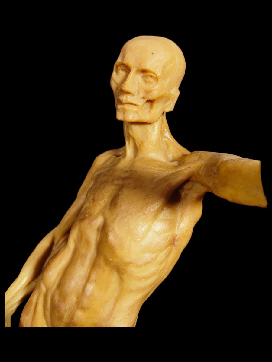 18th Century Anatomical Wax Model-photo-4