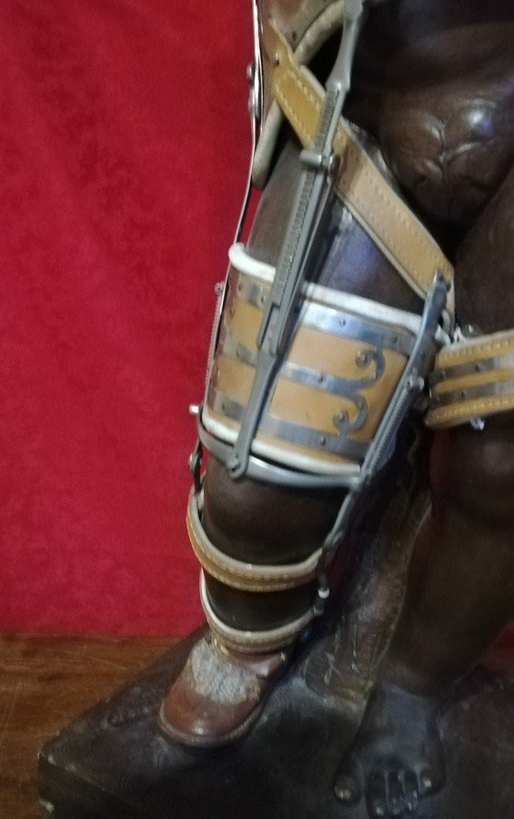 Sculpture orthopédique -photo-1