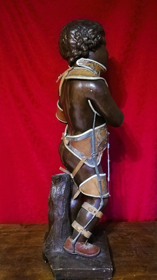 Sculpture orthopédique -photo-5