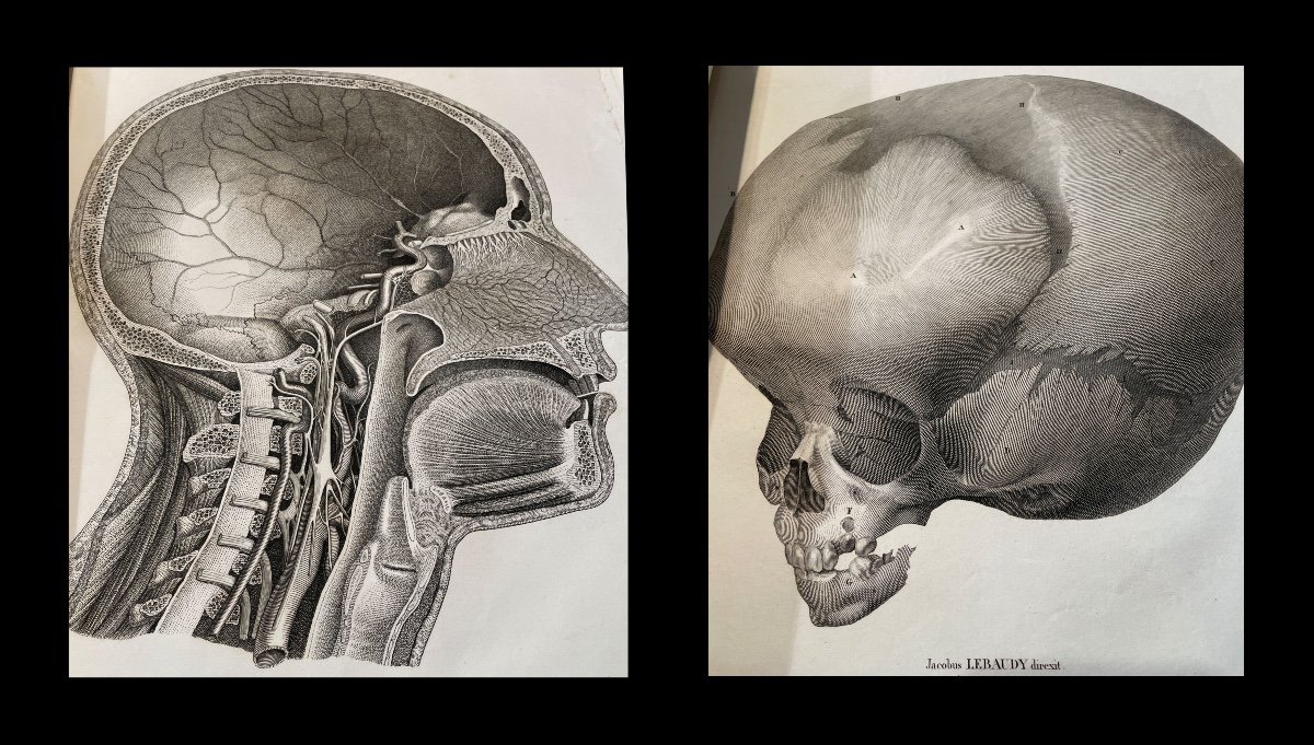 Medecine Anatomie Chirurgie Obstetrique. Atlas De 143 Planches. Vers 1850.-photo-3