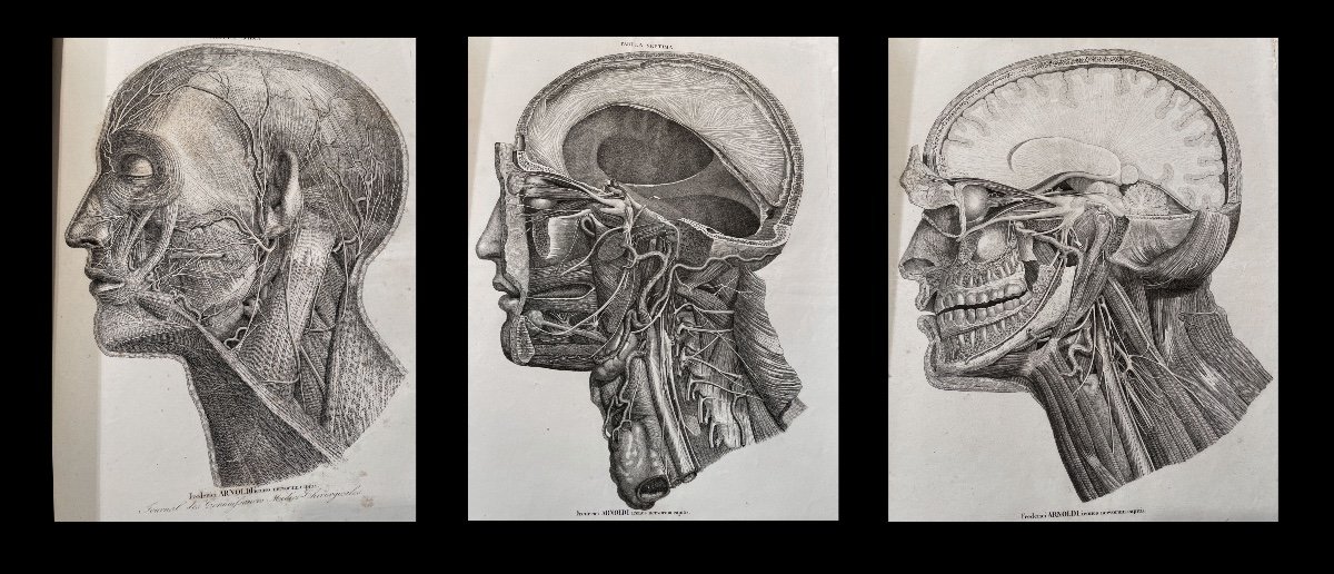Medecine Anatomie Chirurgie Obstetrique. Atlas De 143 Planches. Vers 1850.-photo-5