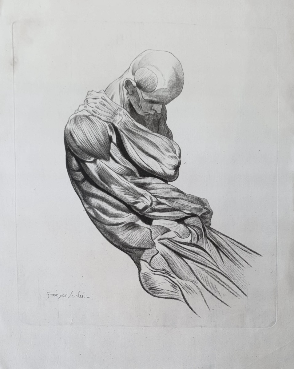 Jean-jacques Lagrenée, A Stooped Man, Holding His Shoulder-photo-2