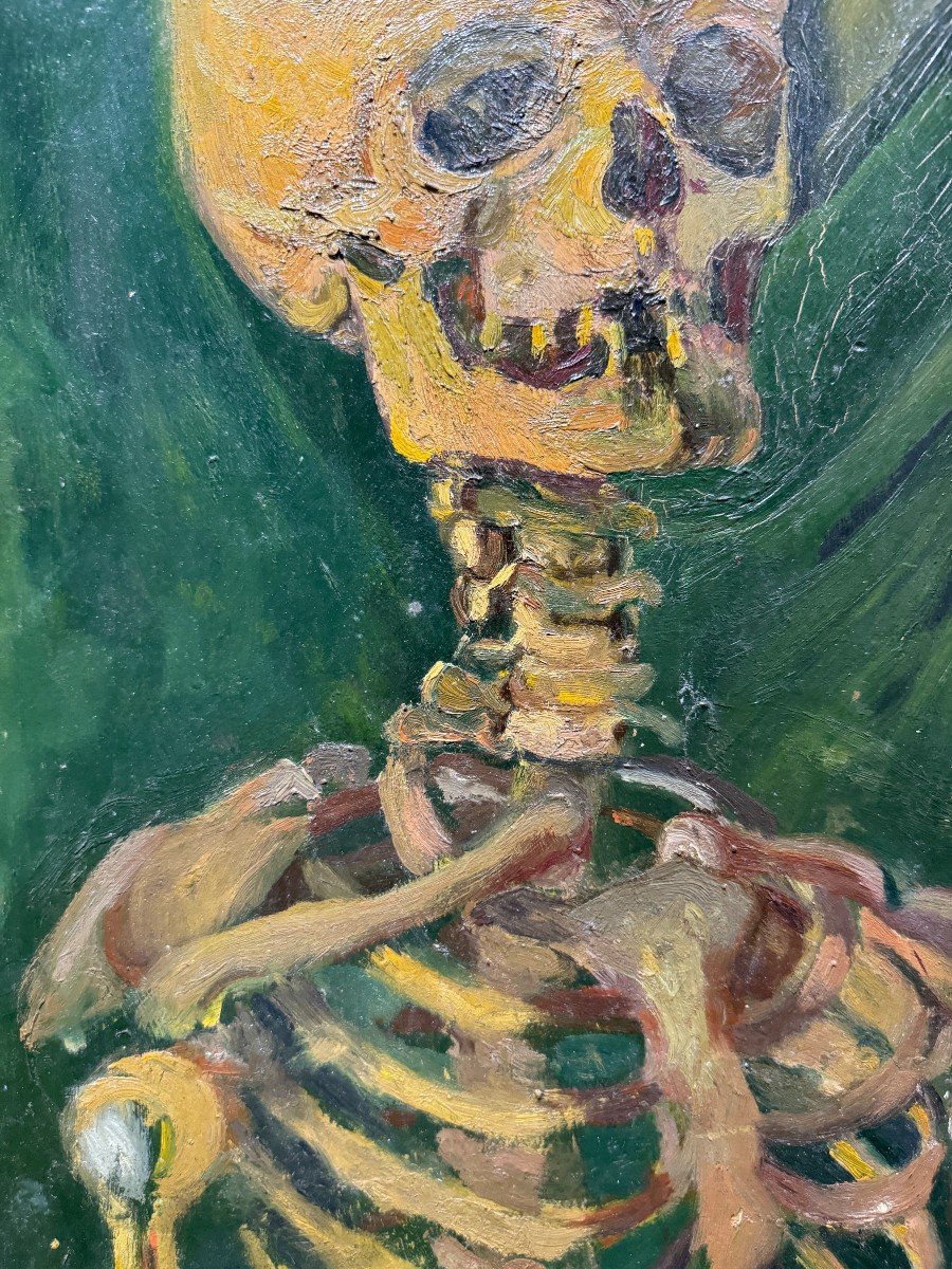 Ecole Française Du 20ème Siècle - Squelette - Dans le gout de Van Gogh-photo-2