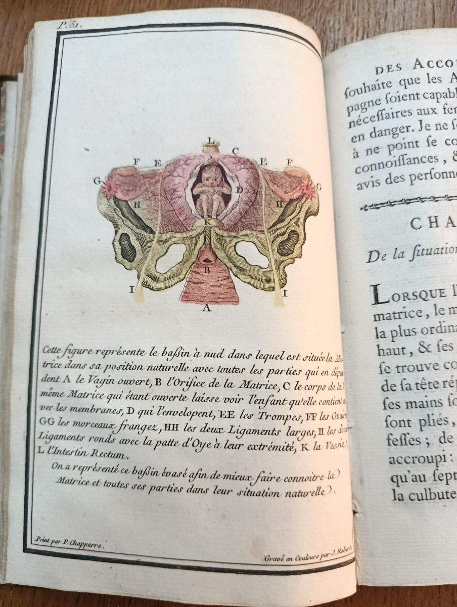A.m. Ducoudray, The Art Of Childbirth, 1777, Simon Printing House-photo-1