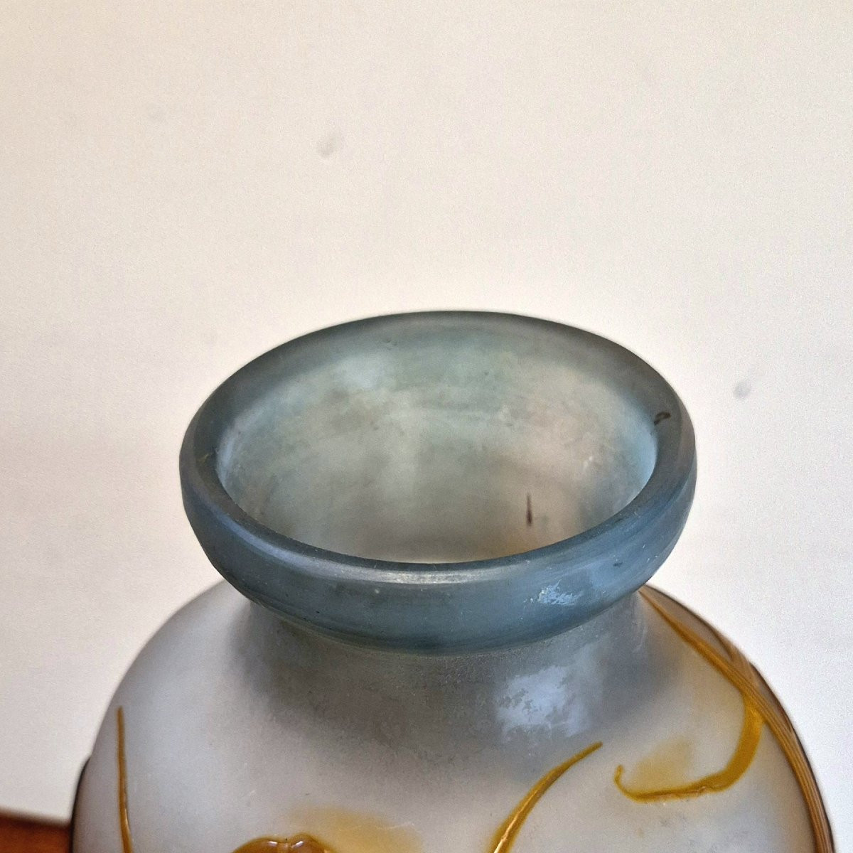 Gall Bladder-photo-3