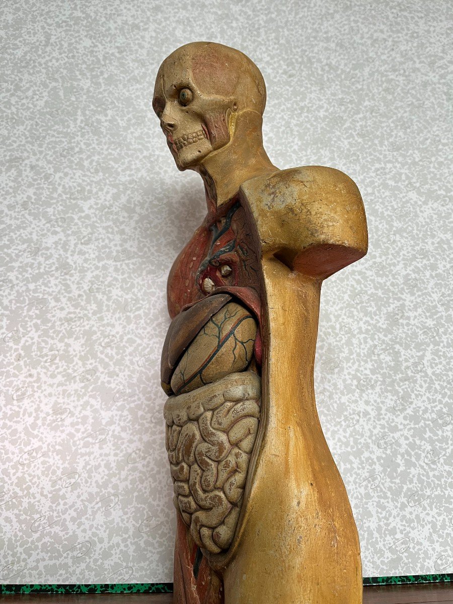 Former Little Flayed-photo-1