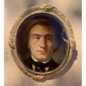CURIOSITÉ - PORTRAIT D'HOMME ATTEINT DE STRABISME - HUILE 19ème SIECLE MONTEE EN BROCHE