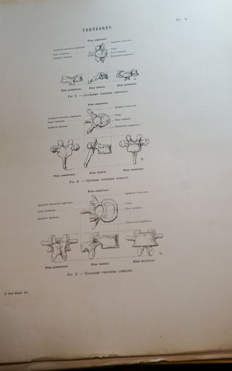 RICHER Paul, "Anatomie artistique, description des formes extérieures du corps humain" 1890-photo-4