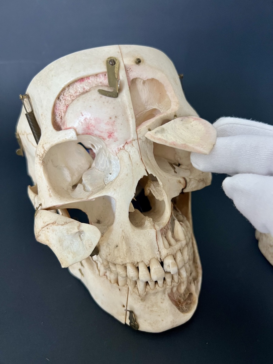 Educational Anatomical Human Skull With Removable Parts –  19th Century-photo-4
