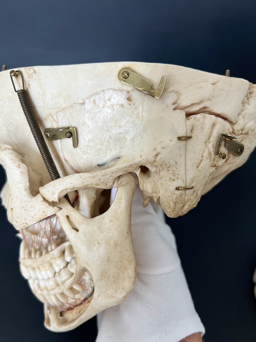 Educational Anatomical Human Skull With Removable Parts –  19th Century-photo-6