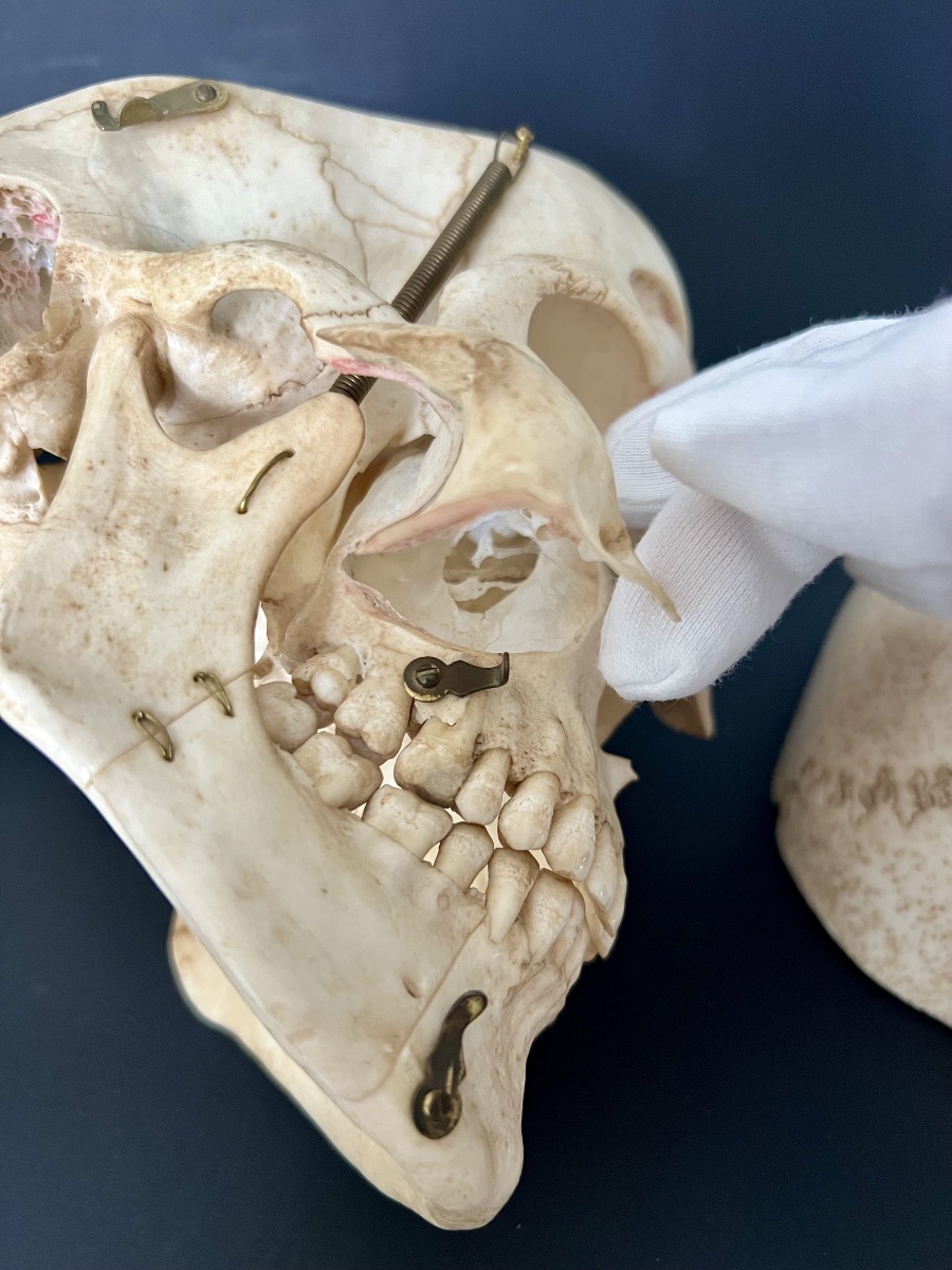 Educational Anatomical Human Skull With Removable Parts –  19th Century-photo-8
