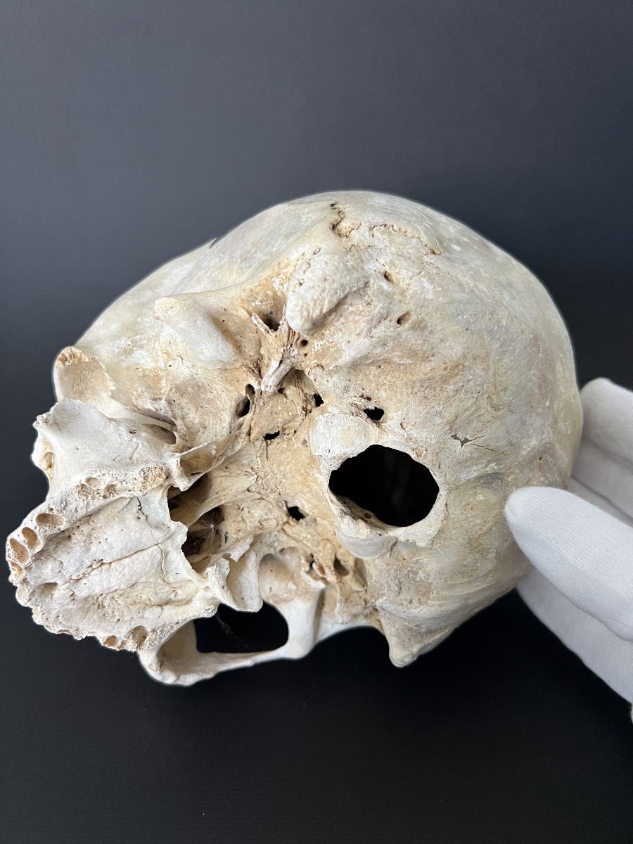 Crâne humain peint – Mémento Mori – daté 1885-photo-6