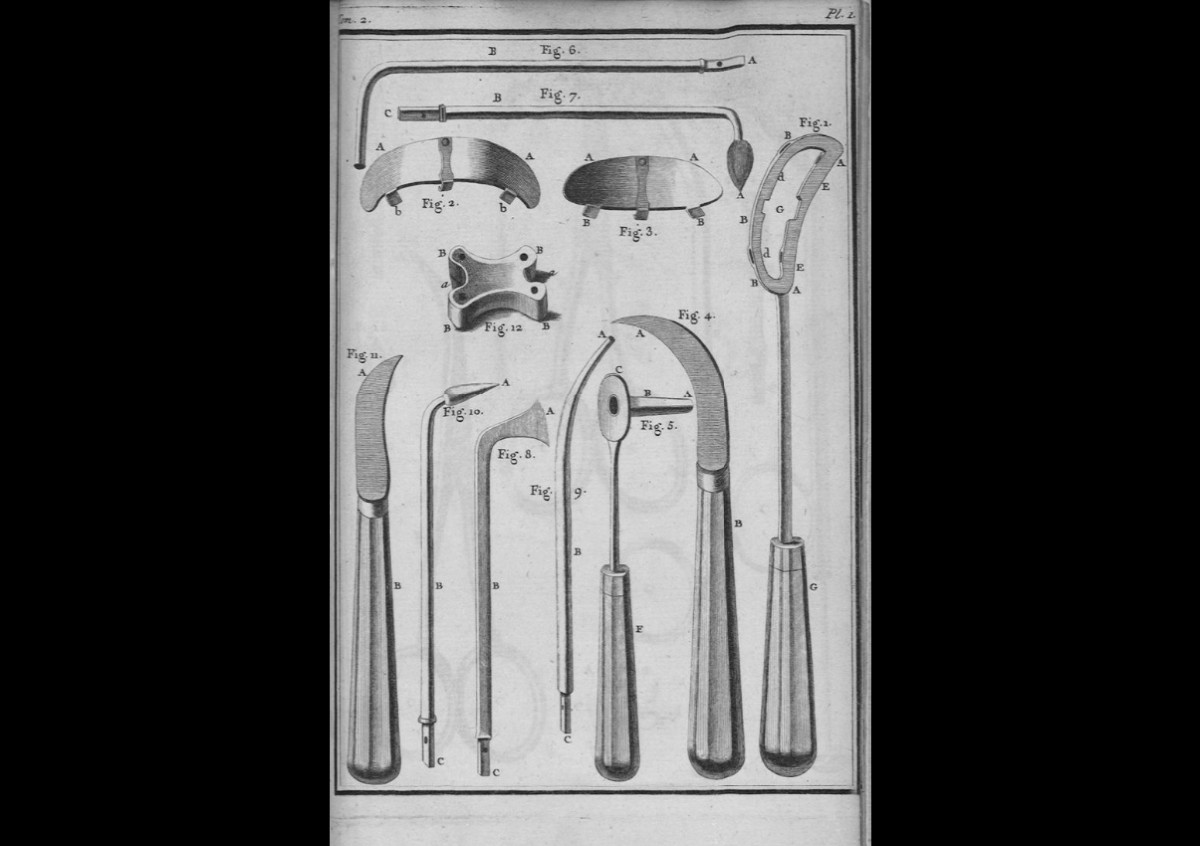 Small Amputation Knife, Circa 1800-photo-3