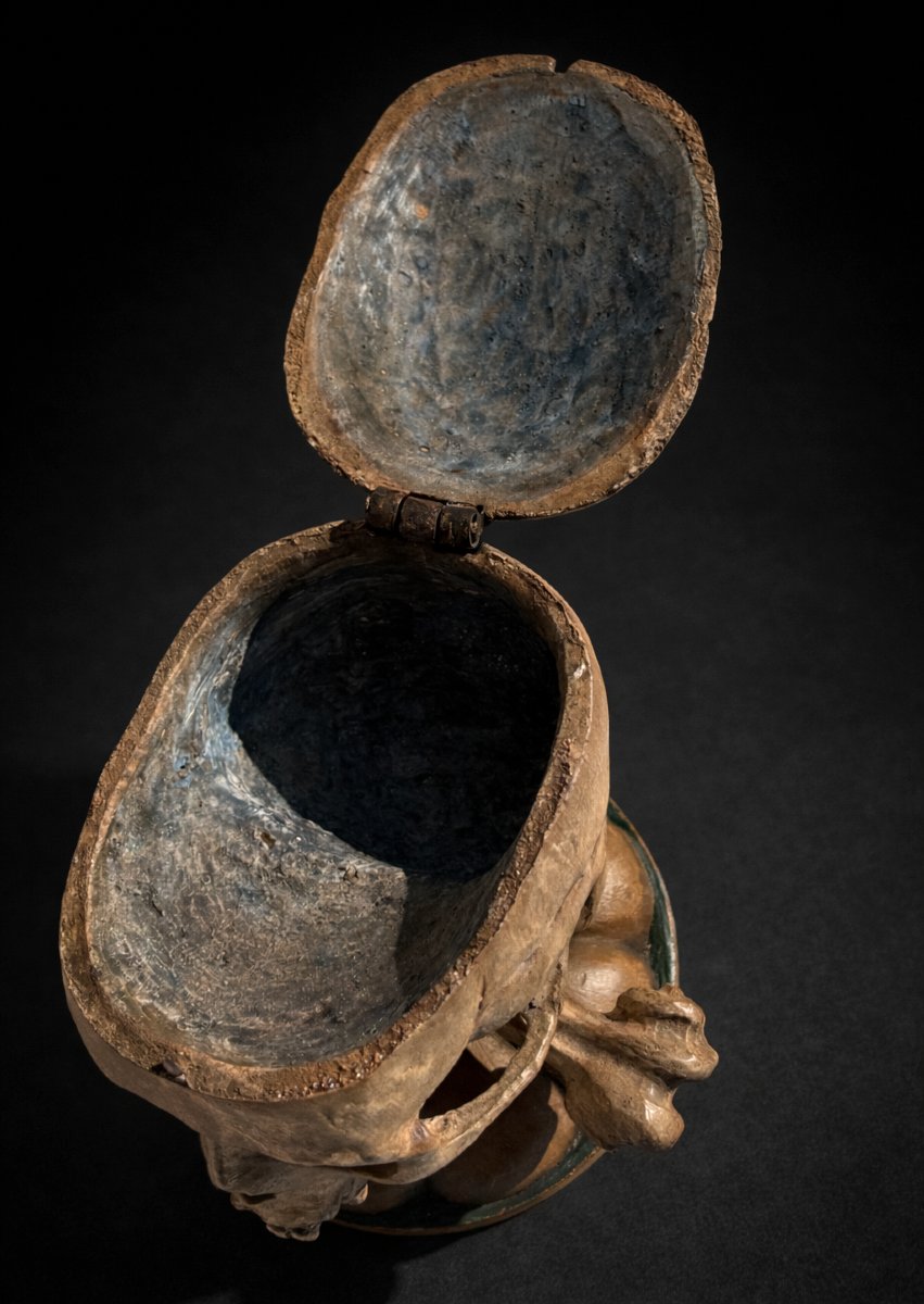 Memento Mori, Human Skull In Papier-mâché, 18th-century Style Reliquary Box, Vanity, Casket-photo-4