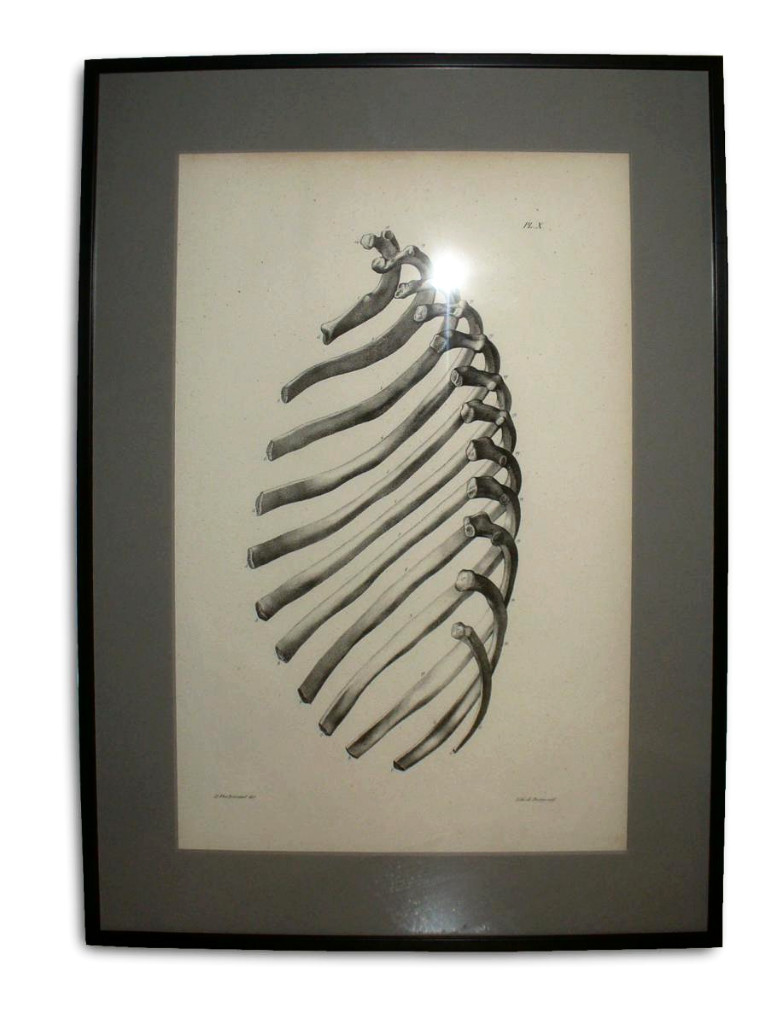 Serie De 6 Grandes Gravures Encadrées , Planches Anatomiques XIXe , Cabinet De Curiosités-photo-3