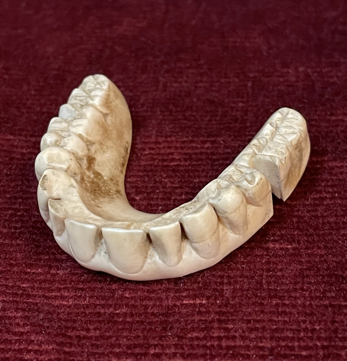 18th Century Denture Made Of Hippopotamus Ivory 