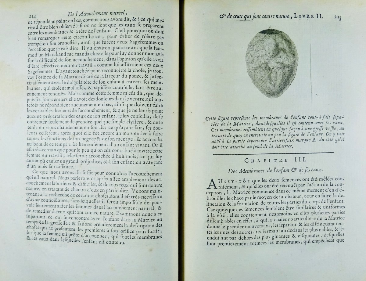 MAURICEAU (François) - Traité des maladies des femmes grosses. 1721, en reliure d'époque.-photo-5