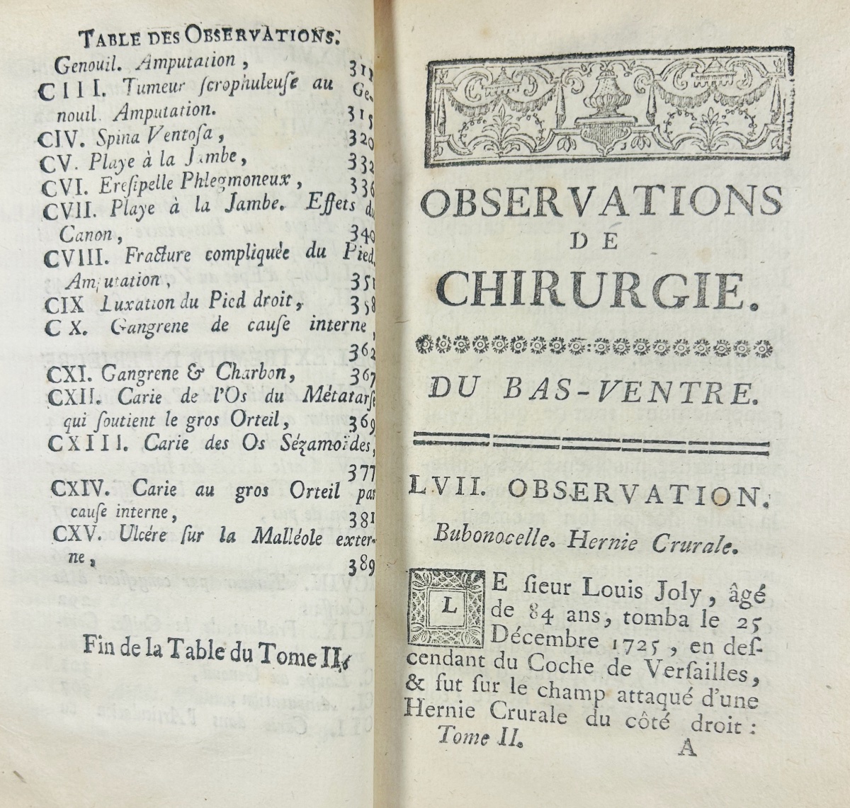 LE DRAN (Henry-François) - Observations de chirurgie. Chez Osmont, 1731, 2 volumes in-12.-photo-5