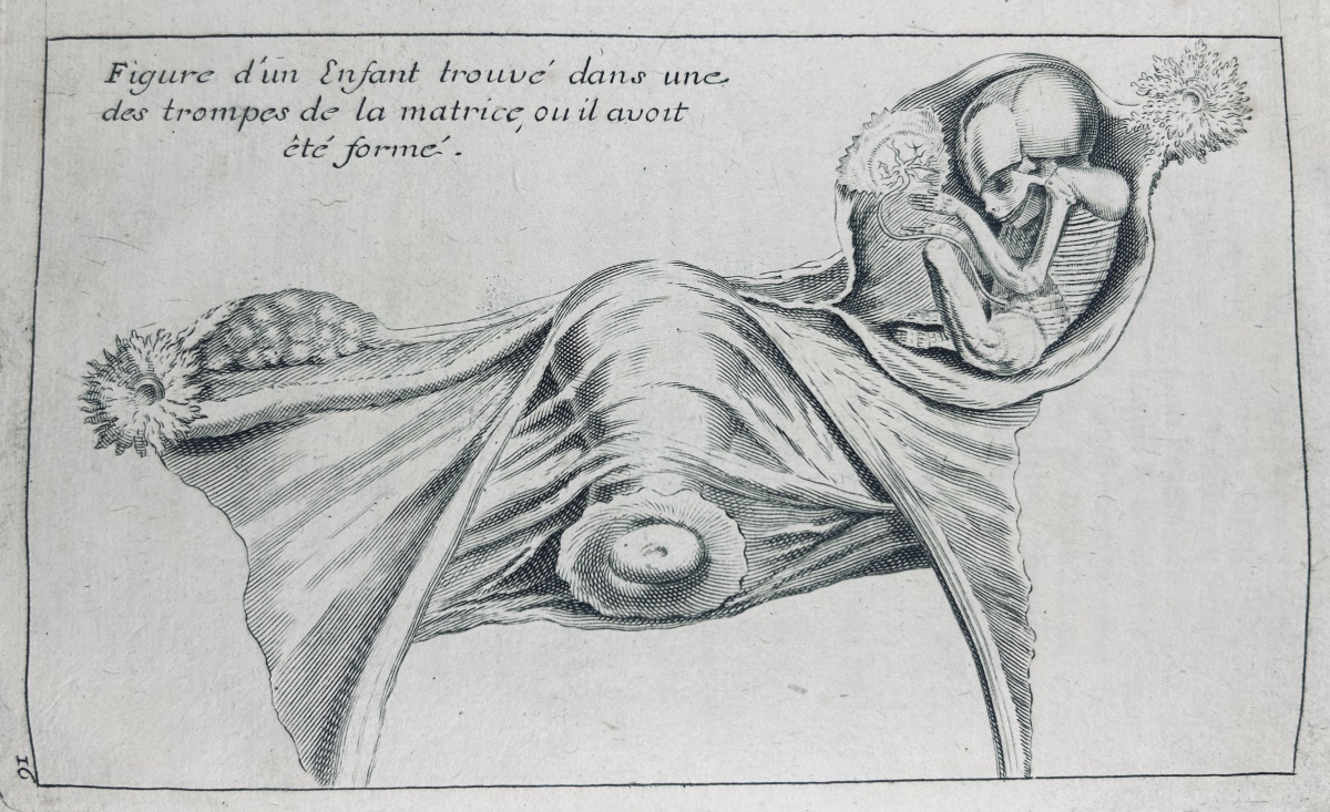 DIONIS - Traité général des accouchemens. Chez Broncard 1721, in-8, reliure plein veau d'époque-photo-1