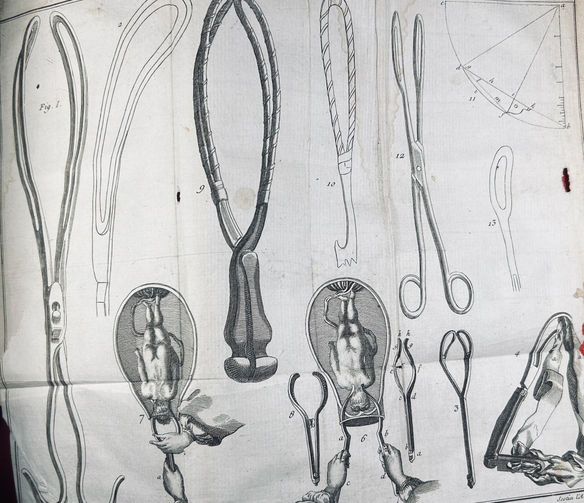 Levret - Observations On The Causes And Circumstances Of Several Difficult Childbirths. 1762.-photo-3