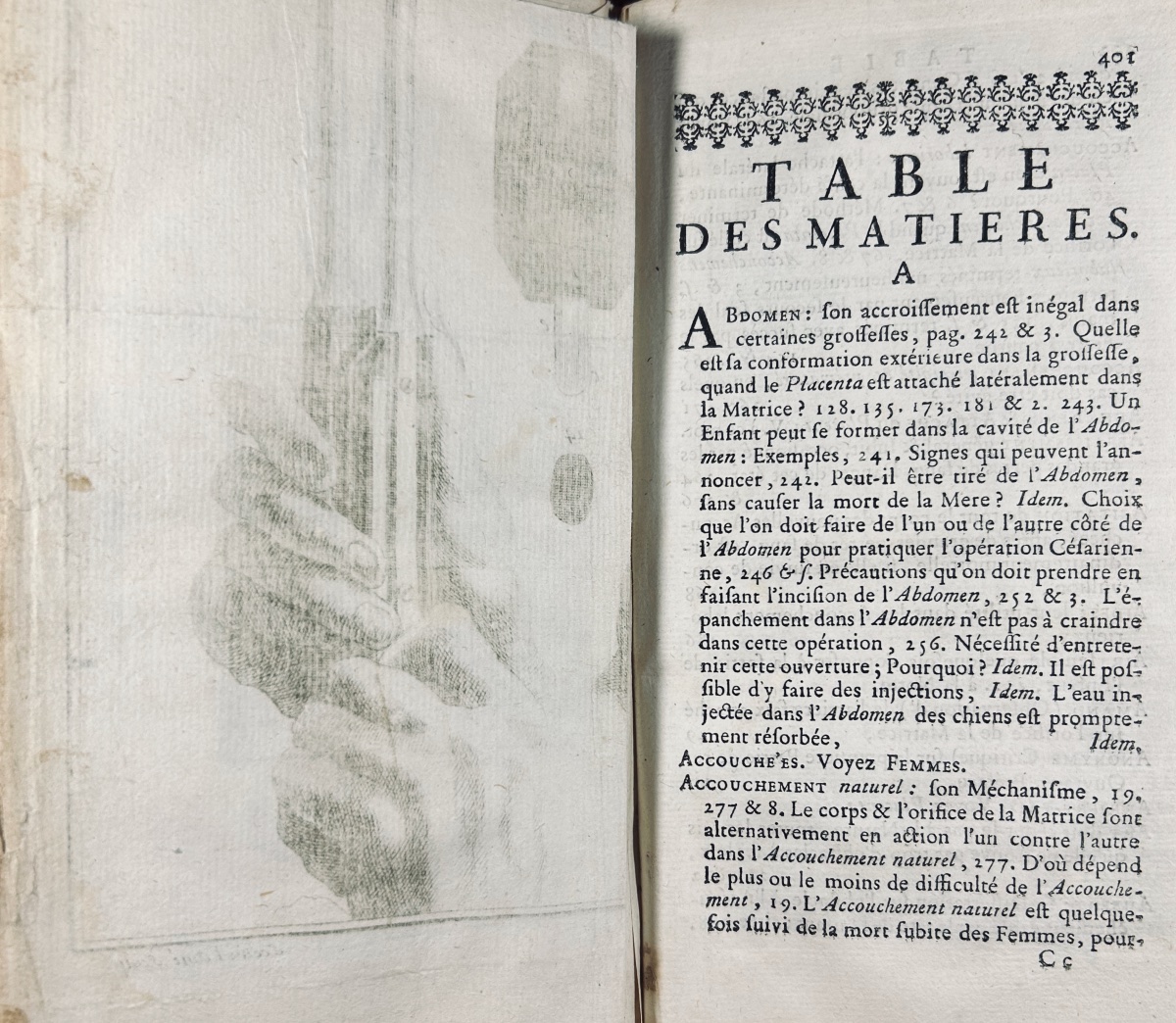 Levret - Observations On The Causes And Circumstances Of Several Difficult Childbirths. 1762.-photo-5