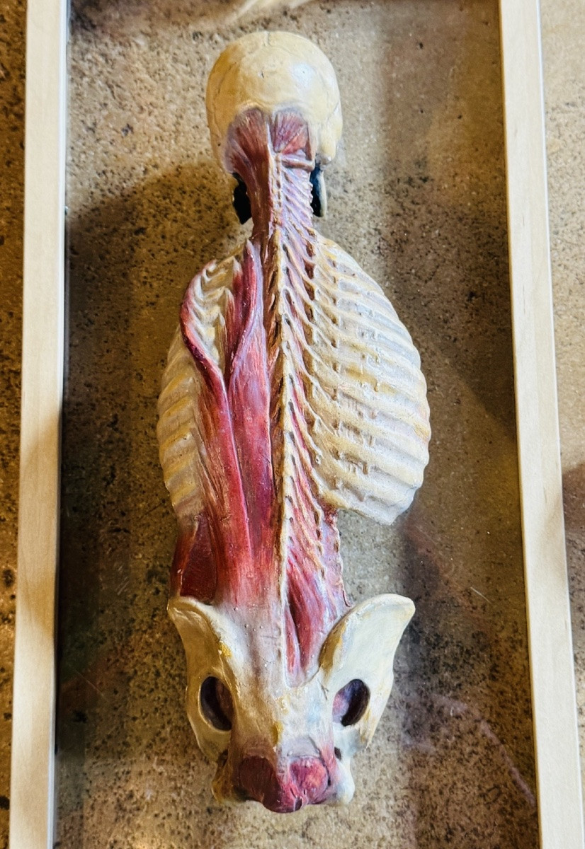 Anatomical écorché In Polychrome Plaster - 20th Century - In The Taste Of Gauthier d'Agoty-photo-4