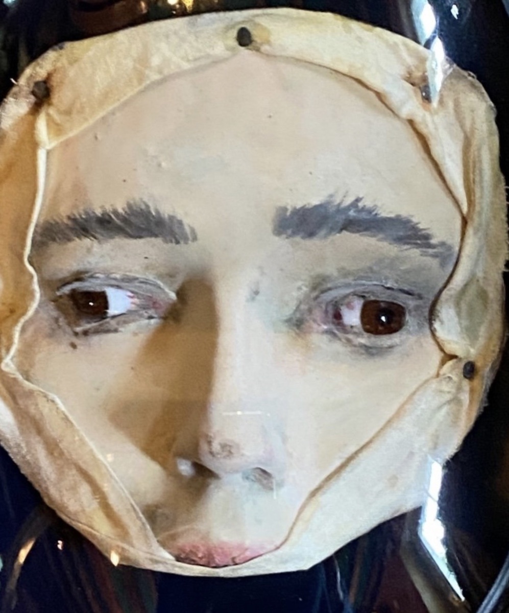 Divergent Strabismus – Anatomical Wax Model Of The Eye, Circa 1900-photo-2