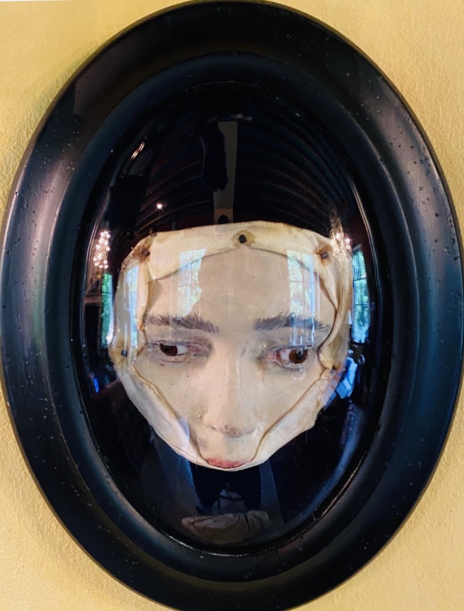 Divergent Strabismus – Anatomical Wax Model Of The Eye, Circa 1900-photo-1