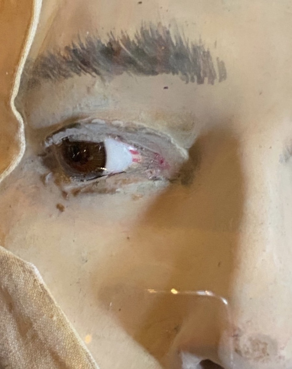 Divergent Strabismus – Anatomical Wax Model Of The Eye, Circa 1900-photo-4