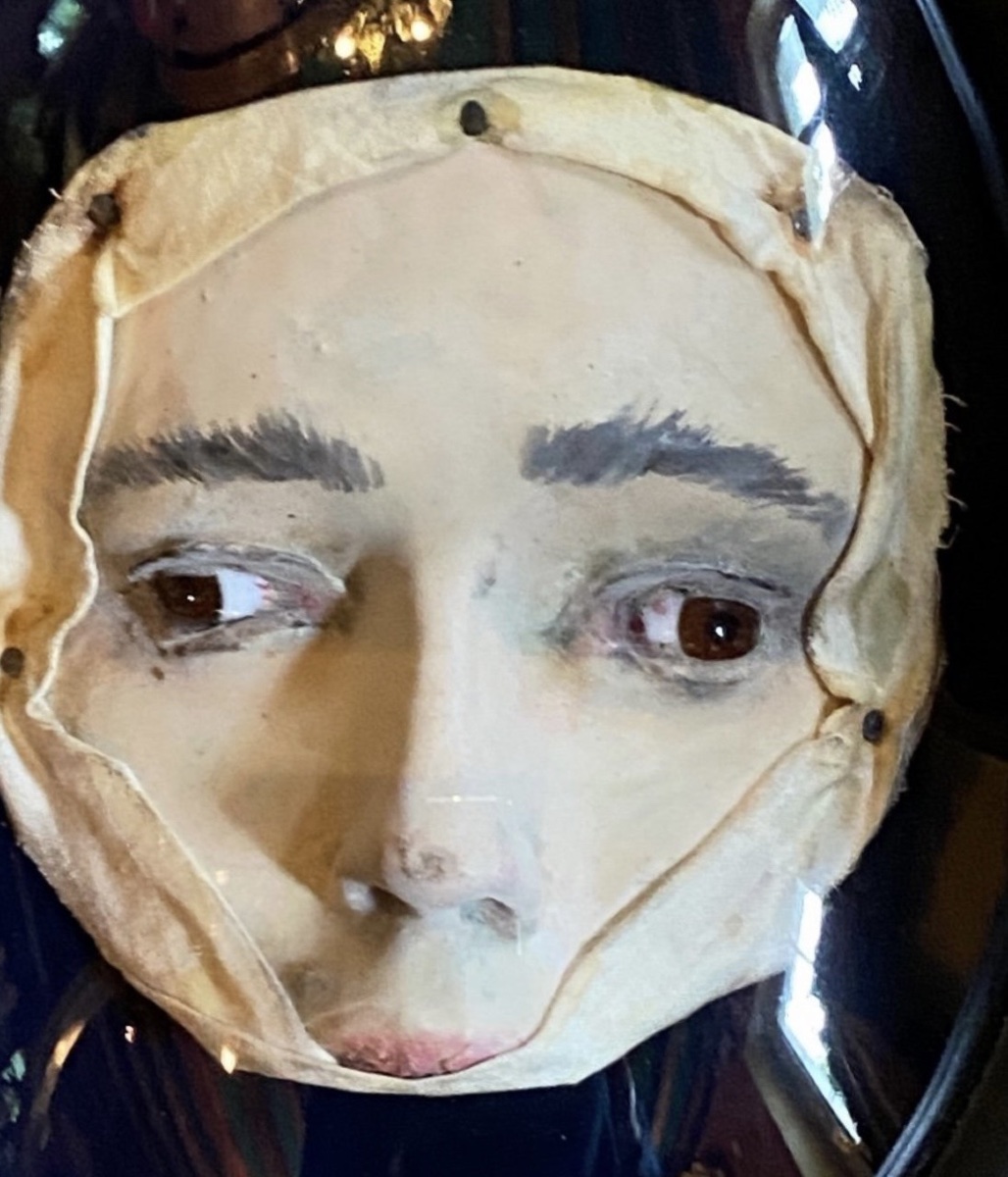 Divergent Strabismus – Anatomical Wax Model Of The Eye, Circa 1900-photo-5