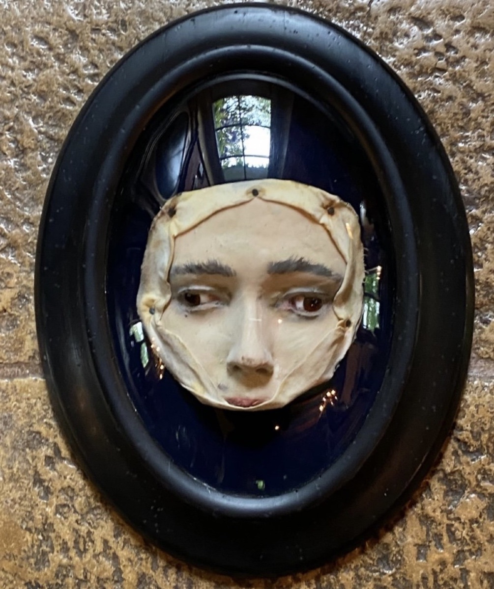 Divergent Strabismus – Anatomical Wax Model Of The Eye, Circa 1900